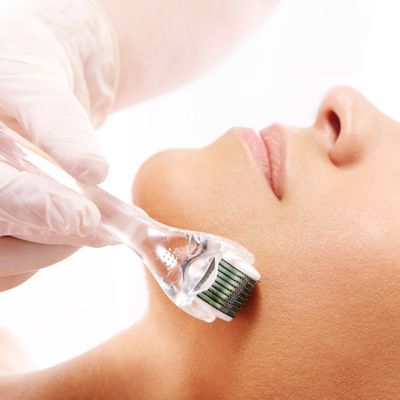 Micro-Needling