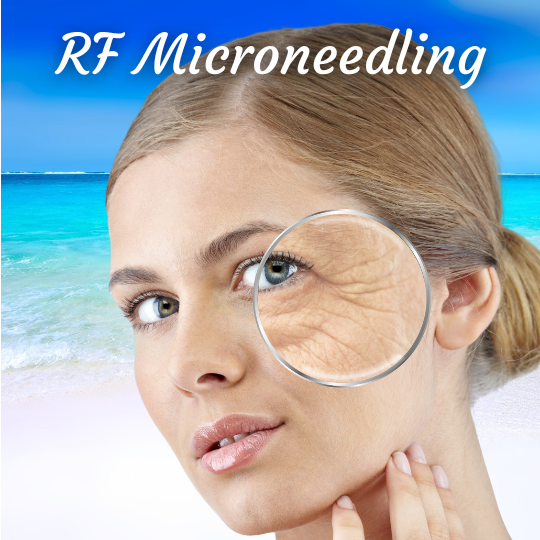 Microneedling