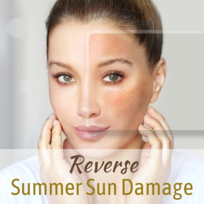 Insights 8_24_22 sun damage 2 Insights 8_24_22 sun damage 2