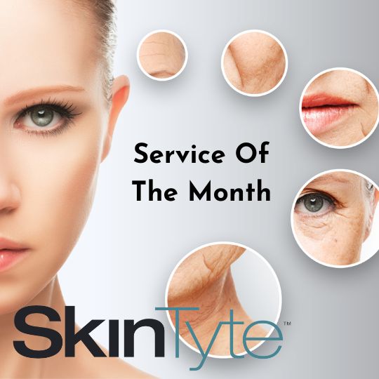 Service of The Month