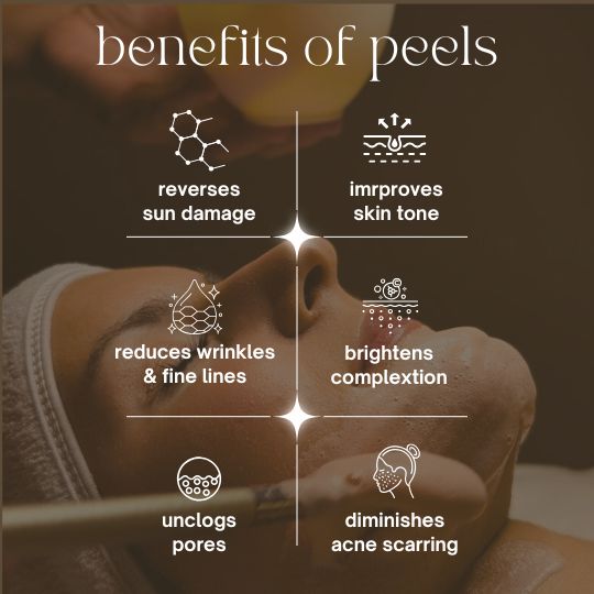 Benefits Of Peels
