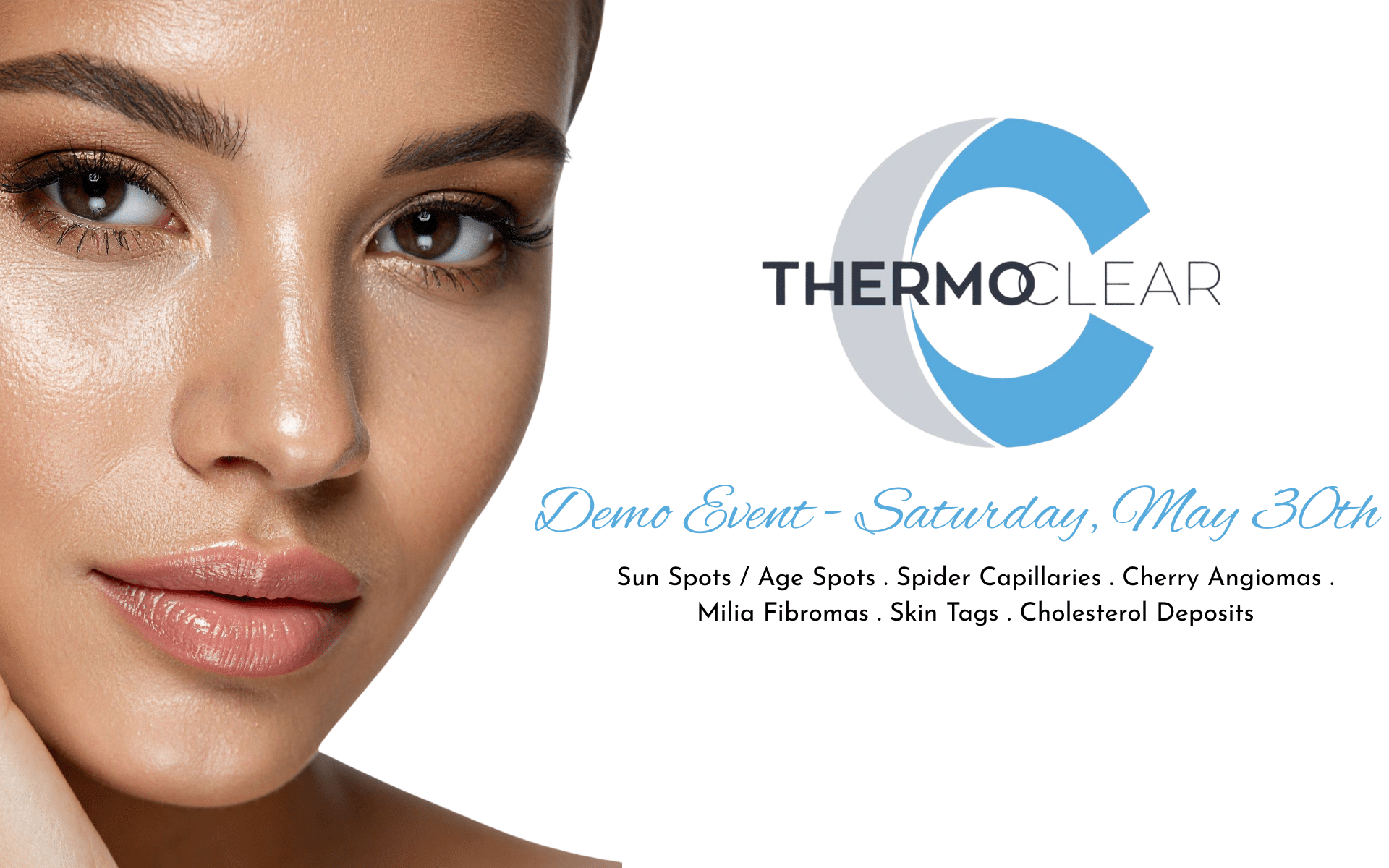 Thermoclear Event